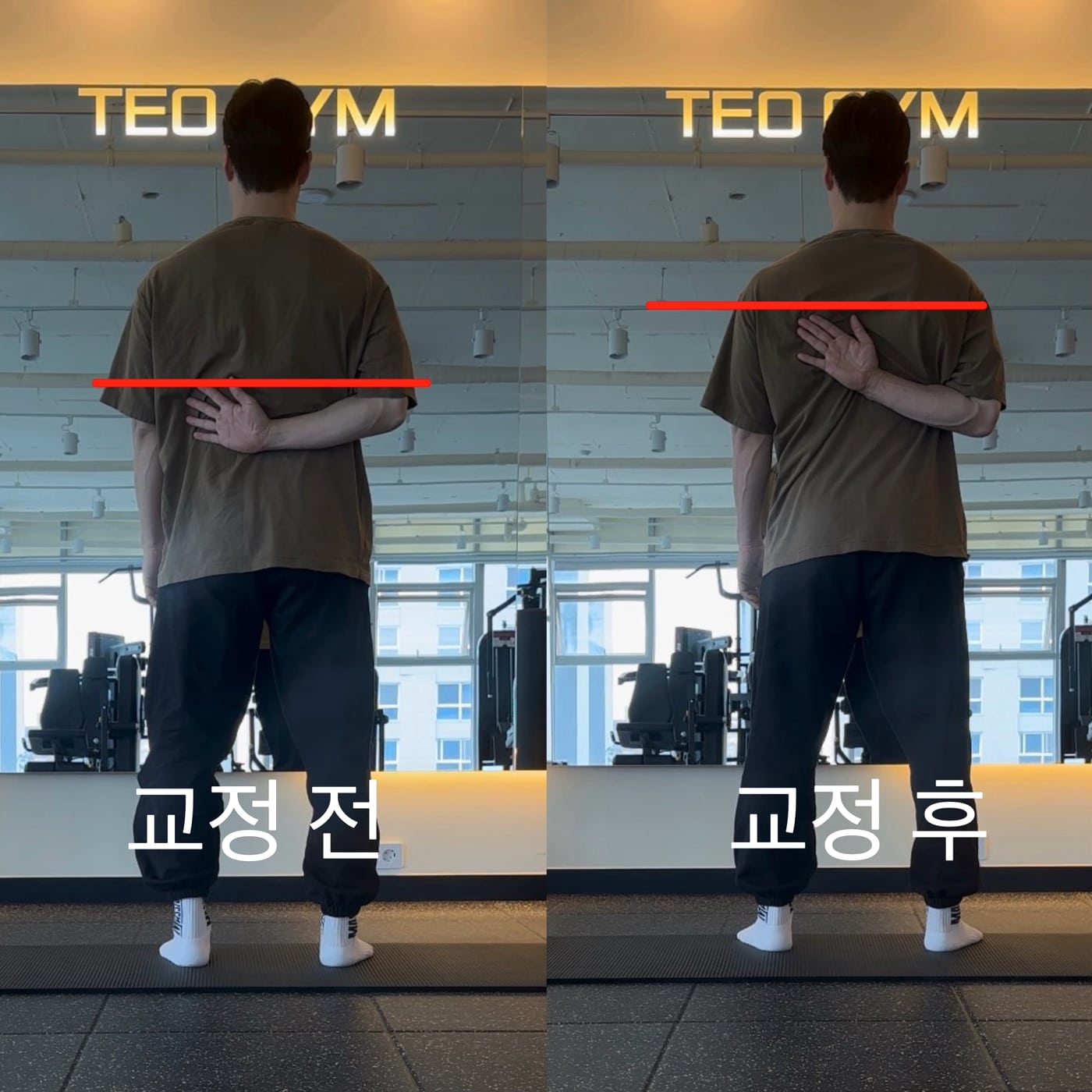 테오짐 체형교정 전후 비교 - 어깨 가동 범위가 달라진 모습